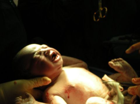 1994 Ford Crown Victoria - A newborn baby is shown crying during its birth, with medical professionals attending.