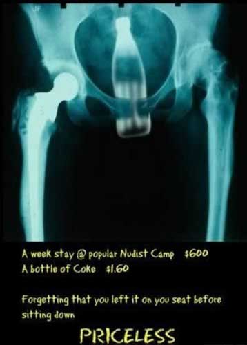 1990 Ford Bronco - This X-ray reveals a surprising item found within a human pelvis, accompanied by text detailing a nudist camp stay and the cost of a Coke.
