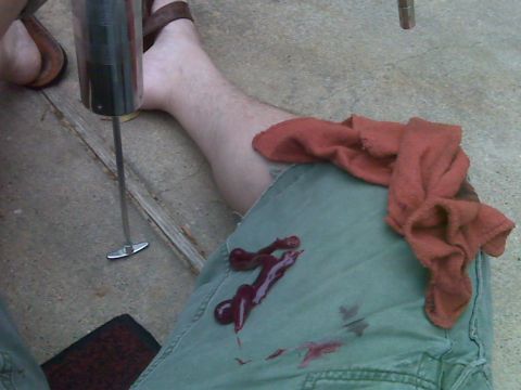 2008 Jeep Wrangler - A person's leg is shown with a wound and bloodstains on their pants, next to a metal tool with a red cloth.