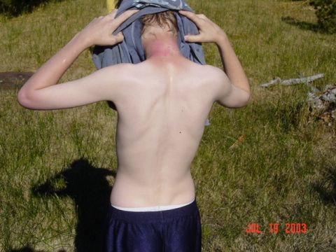 1989 Ford Bronco - A person is seen from behind, with sunburn on their neck and shoulders, as they pull a shirt over their head in a grassy outdoor setting.