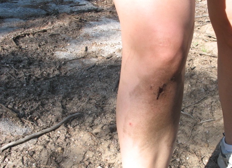 1978 Ford Bronco - A close-up view of a dirty human leg, showing a small wound on the knee, set against a backdrop of dirt and debris.