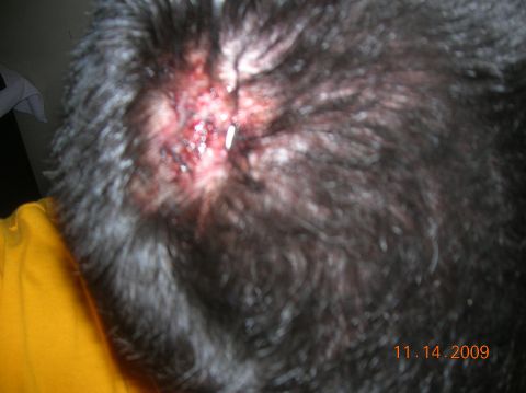 1985 Ford Bronco - A close-up view of a wound on a person's head, with the date 11.14.2009 visible in the corner.