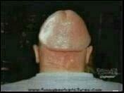 1978 Ford F-250 - Unusual hairstyle on the back of a person's head.