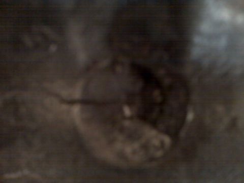 1983 Ford Bronco - chipped plug weld with a piece of weld from 1oclock to 4 oclock that moves around
