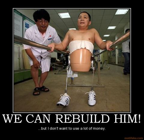 1989 Ford Bronco - A man with prosthetic legs is undergoing physical therapy with assistance from a medical professional.