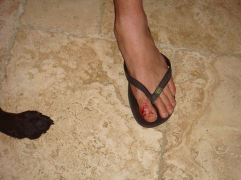 1992 Ford Bronco - A close-up shows a human foot with an injured toe and a dog's paw on a tiled floor.