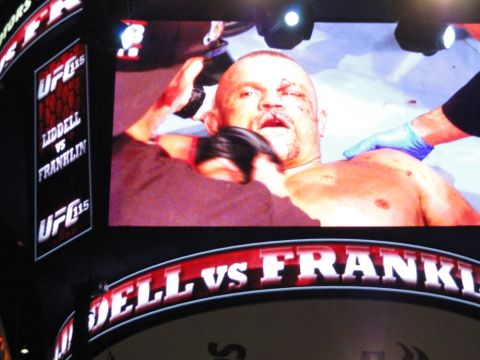 1996 Ford Bronco - A close-up view of a fighter receiving medical attention during a UFC event, with event details displayed on screen.