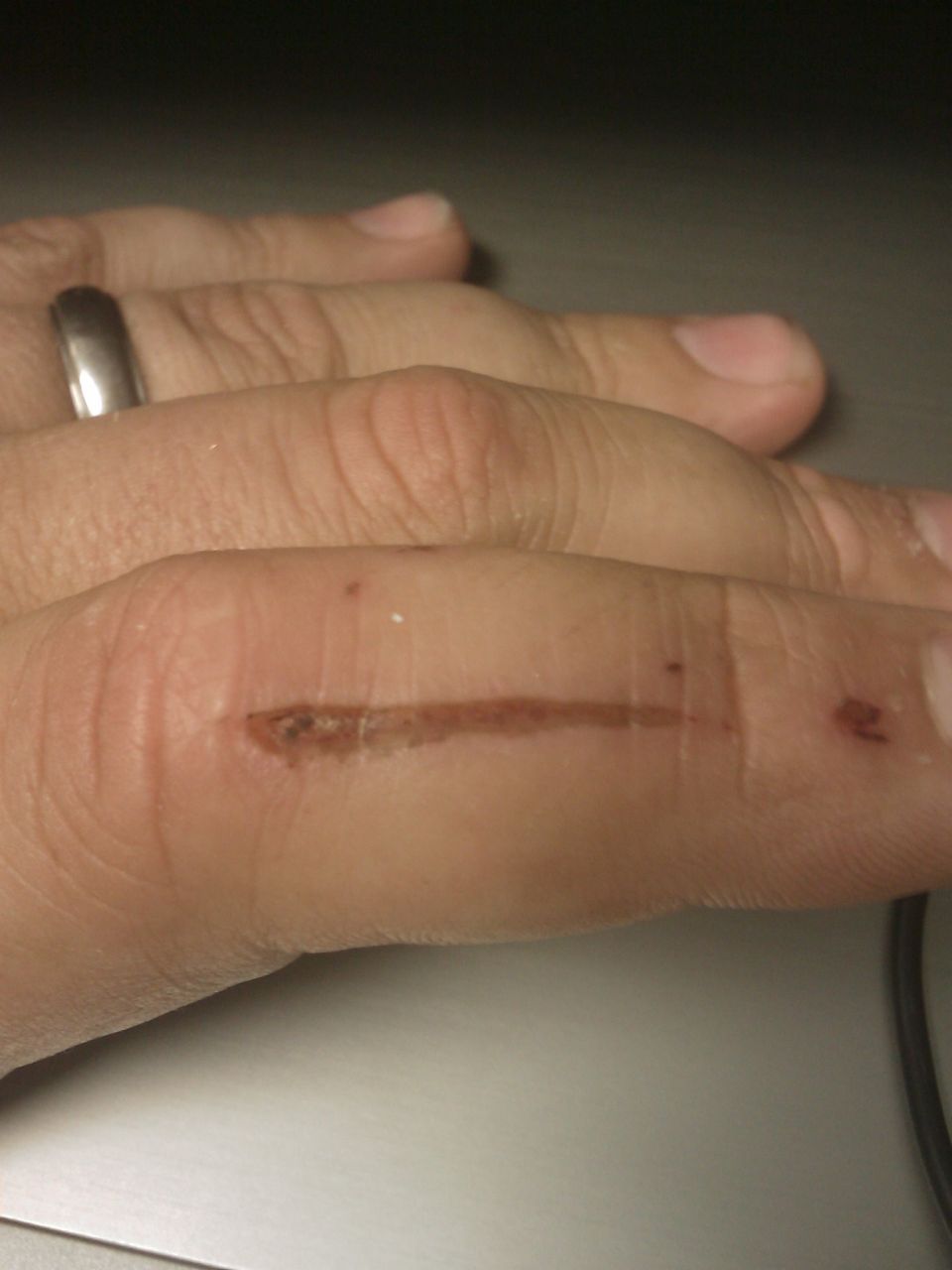 Only injury of the weekend.  this is why you should wear leather gloves when using a grinder with no guard.