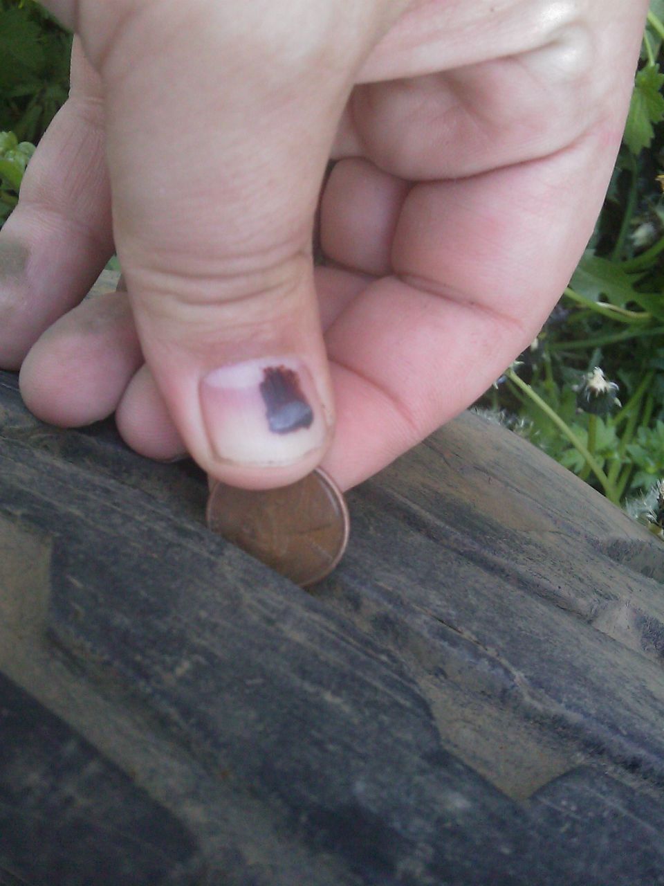 Hand with bruised fingernail holding a penny over a textured surface