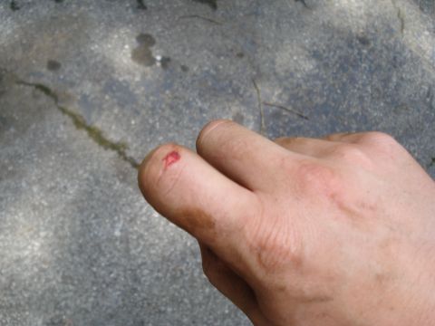 1994 Ford F-350 - A close-up view of a cut finger, showing a small wound and blood against a textured concrete background.