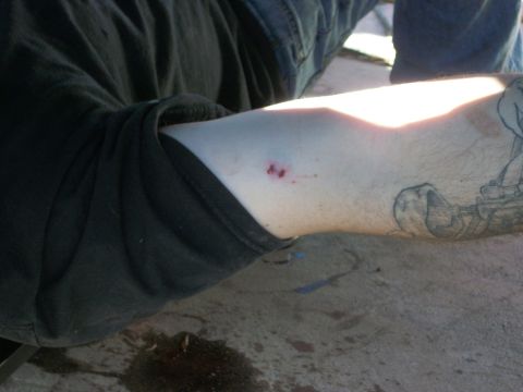 1969 Ford F-250 - Arm with tattoo and small cuts, with a black shirt sleeve visible.