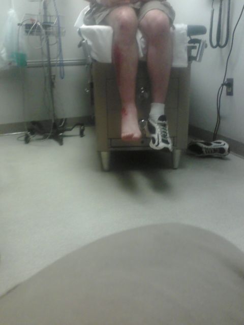 1988 Ford Bronco - A person's leg shows injuries while sitting on a medical examination table.