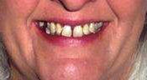 1972 Ford Ranchero - A close-up of a mouth reveals visible teeth, with a watermark for "SUPERMOTORS www.supermotors.net" in the lower right corner.
