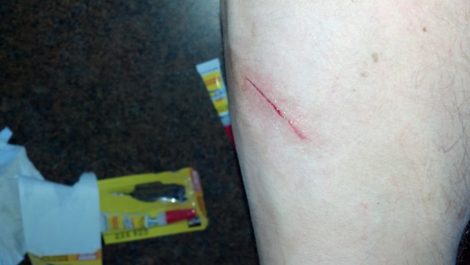 Cut on leg with visible blood, next to a tube of ointment and a blister pack containing a tool