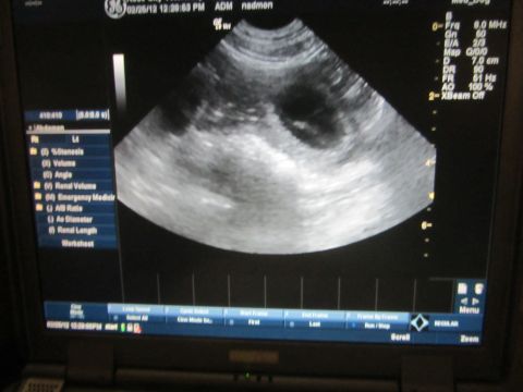 1968 Ford Mustang - Photograph of an ultrasound machine screen showing a sonogram, not a vehicle technical document.