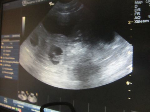 1968 Ford Mustang - This ultrasound image displays internal anatomy with various data readouts on the monitor.