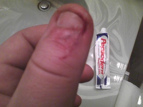 2003 Ford Crown Victoria - A thumb with cuts is shown next to a tube of Pepsodent toothpaste, with a sink visible in the background.