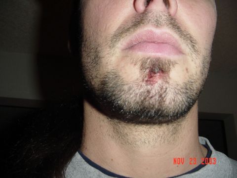 1989 Ford Bronco - got my Labret pierced today...