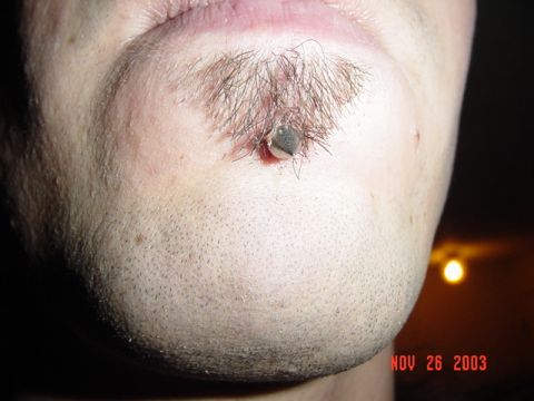 1989 Ford Bronco - Close-up of a chin with stubble and a piercing, dated November 26, 2003.