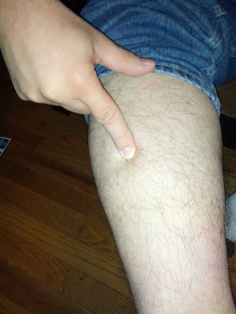 1979 Ford F-150 - A finger points to a spot on a hairy leg, with denim jeans visible above.
